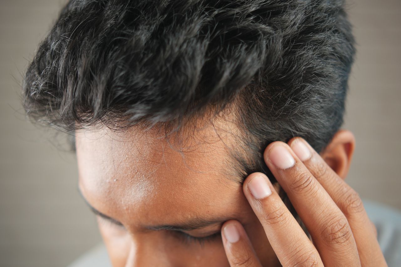 Treatment moment — scalp hair loss